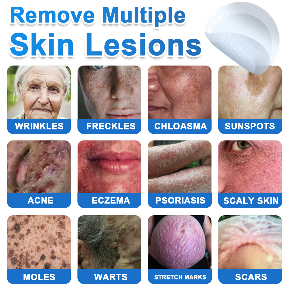🔥Last Day 80% OFF 👨‍⚕️  Neslemy® 2-in-1 Microneedle & Hydrocolloid Patch | Raised Moles,Acne,  Flat Warts & Skin Tags Remover | Improves Wrinkles, Scars & Blemishes | Invisible Pimple Patches for Face & Body