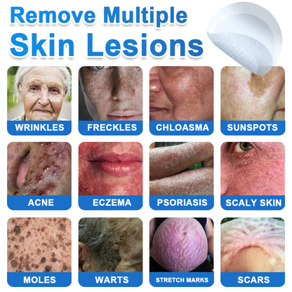 🔥Last Day 80% OFF 👨‍⚕️  Neslemy® 2-in-1 Microneedle & Hydrocolloid Patch | Raised Moles,Acne,  Flat Warts & Skin Tags Remover | Improves Wrinkles, Scars & Blemishes | Invisible Pimple Patches for Face & Body