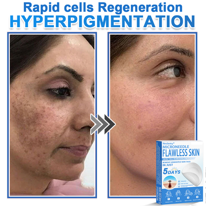🔥Last Day 80% OFF 👨‍⚕️  Neslemy® 2-in-1 Microneedle & Hydrocolloid Patch | Raised Moles,Acne,  Flat Warts & Skin Tags Remover | Improves Wrinkles, Scars & Blemishes | Invisible Pimple Patches for Face & Body