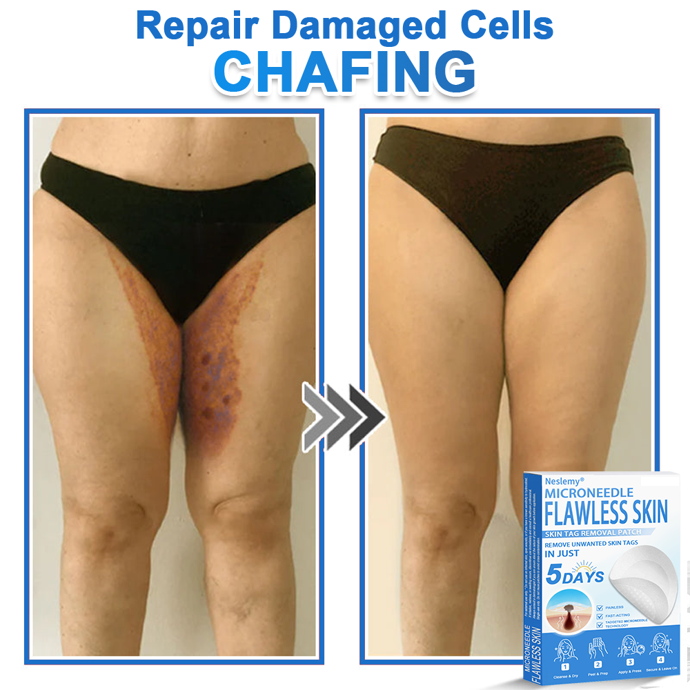 🔥Last Day 80% OFF 👨‍⚕️  Neslemy® 2-in-1 Microneedle & Hydrocolloid Patch | Raised Moles,Acne,  Flat Warts & Skin Tags Remover | Improves Wrinkles, Scars & Blemishes | Invisible Pimple Patches for Face & Body