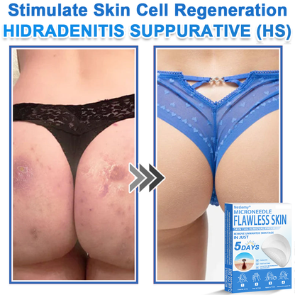 🔥Last Day 80% OFF 👨‍⚕️  Neslemy® 2-in-1 Microneedle & Hydrocolloid Patch | Raised Moles,Acne,  Flat Warts & Skin Tags Remover | Improves Wrinkles, Scars & Blemishes | Invisible Pimple Patches for Face & Body