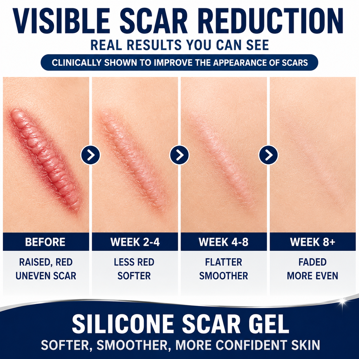 SILICONE SCAR GEL Flatten. Soften. Fade. - PharmacistRecommended Scar Therapy