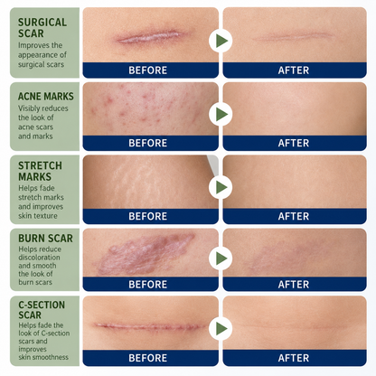 SILICONE SCAR GEL Flatten. Soften. Fade. - PharmacistRecommended Scar Therapy