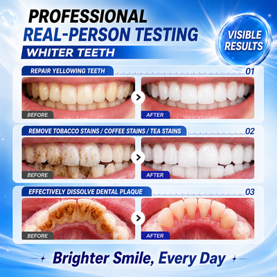 🎁 BUY 1 GET 1 FREE-Niacinamide + Charcoal Whitening Toothpaste