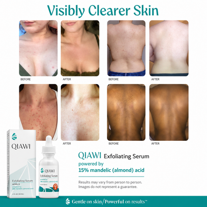 🎁 BUY 1 GET 1 FREE- QIAWIE xfoliating Serum